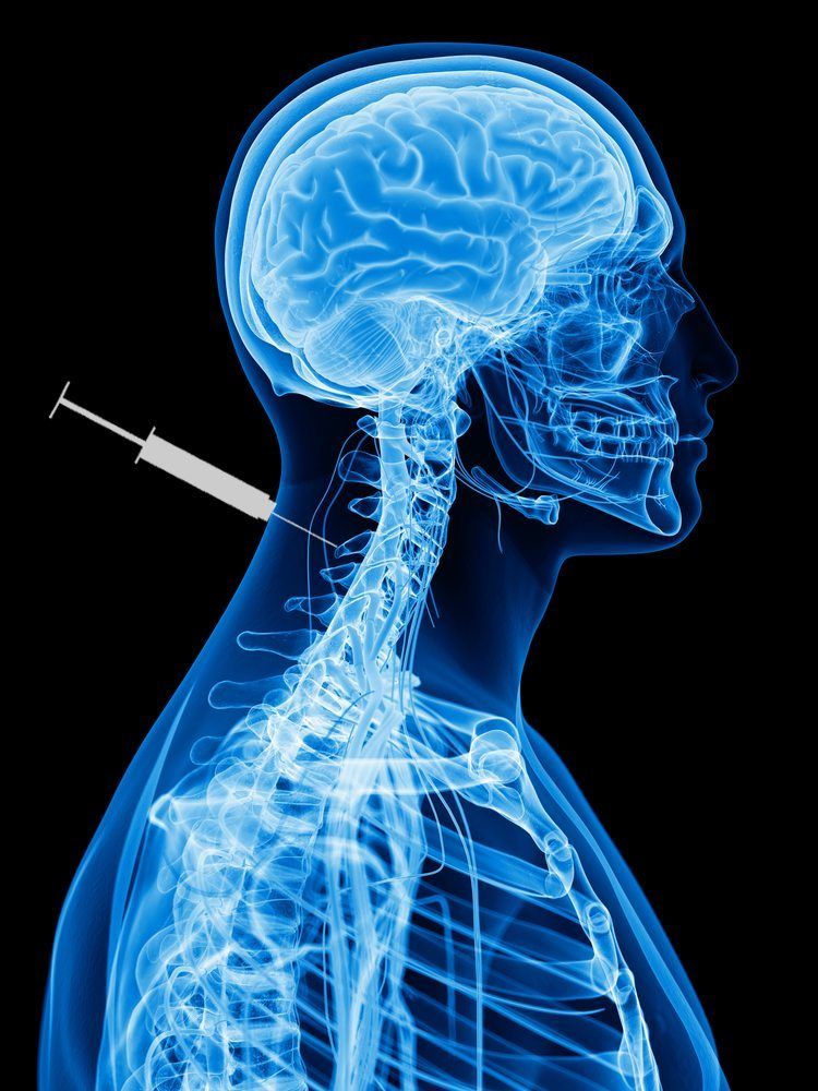 cervical-medial-branch-block-fort-worth-neurosurgeon-dr-diana-wilson